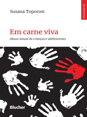 cover image of Em carne viva